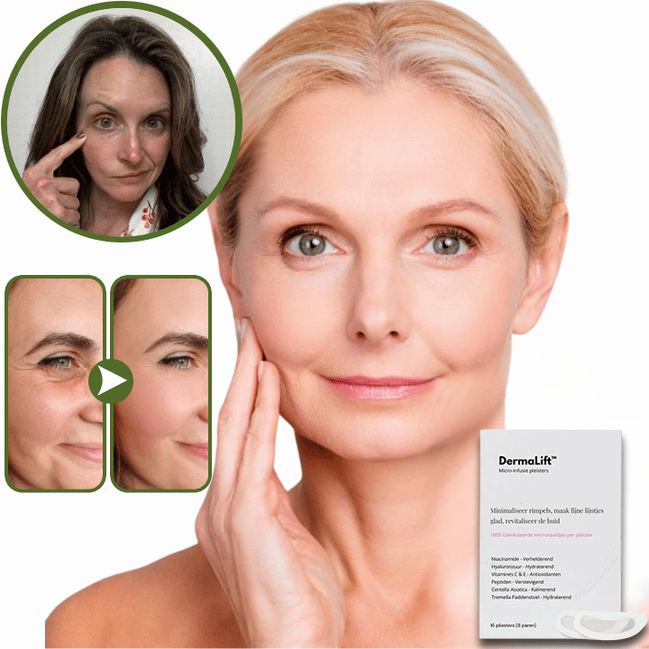 DermaLift™ Micro-Infusie pleisters